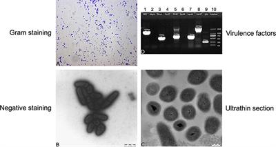 A Virulent Trueperella pyogenes Isolate, Which Causes Severe Bronchoconstriction in Porcine Precision-Cut Lung Slices